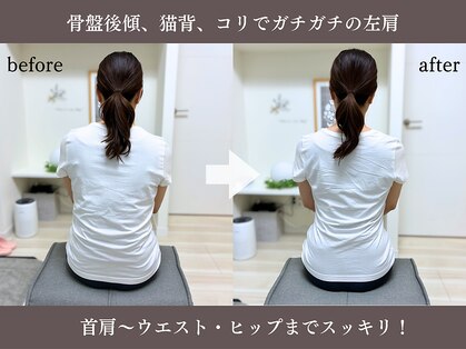エーアール(AR)の写真