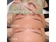 ソイズエステティクスの写真