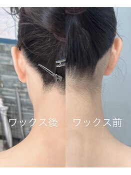 チュルリ 新町店(Chururi)/ワックス脱毛/シュガーリング