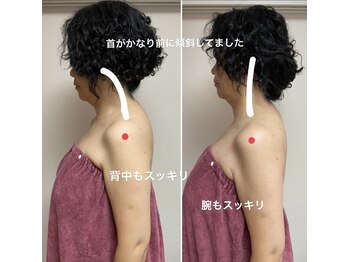 コルッソ(CoLusson.)/頸椎ケアでストレートネック改善