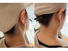 エヌクレアール(Ncrear)/うなじワックスBefore→After