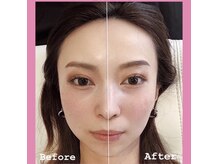 コガオ ファクトリー(KOGAO FACTORY)の雰囲気（たるみ/シワ/くすみを改善し自分史上最少の小顔と美肌が2980円！）