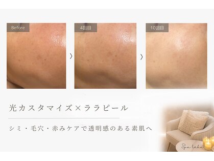スパレーカ(Spa laka)の写真
