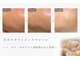 スパレーカ(Spa laka)の写真