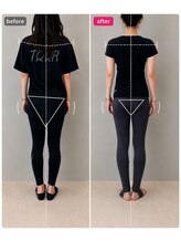 ホリック アイス コア ボディ(HOLIC ICE CORE BODY)/お客様のビフォーアフター10