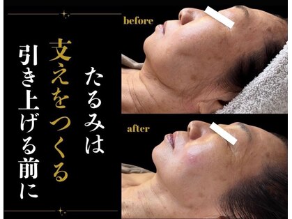 フル(Full)の写真