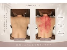 チョアチョア 立川本店(CHOA-CHOA)の雰囲気（ユギカッサでの老廃物促進★【むくみ/デトックス/冷え性改善】）