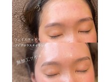 ハナサクラ 心斎橋(HANASAKURA)の雰囲気(Waxでくすみの原因となる古い角質や産毛を除去してメイクのりUP)