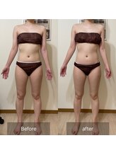 エミニー(EMINY)/