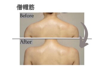 ラグラン銀座メディカルエステ 高輪ゲートウェイ店/加工アプリレベルでもっこり肩減