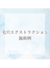 ボータン 恵(Beau Temps)/