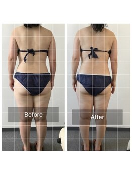 ボディメイクサロンアプローズ/ボディライン変化