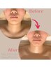 【facial】美顔器使用/ヒト幹細胞使用 エイジングフェイシャル80分
