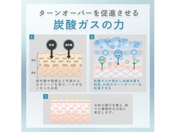 フォーケア(4Care)/炭酸プラズマ