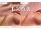 イリゼ(iriser)の写真
