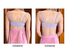 エミニナル(EMININAL)/バストケア【ビフォーアフター】