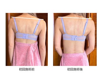 エミニナル(EMININAL)/バストケア【ビフォーアフター】