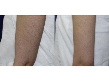 スリリアン 銀座/★お客さまビフォーアフター★