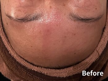 ダイヤモンド リーエンダ(Diamond leende)/クレイハーブピーリング