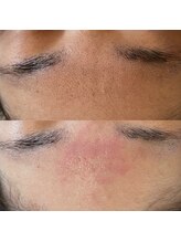 アンク(Ankh)/額の黒ずみで悩んでいませんか？