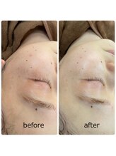 ハクミー(haku me)/☆次世代リバイブハーブ☆