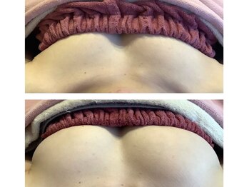 サロンドソワカ(salon de SOWAKA.)の写真/サイズアップも美バストも！お客様に合ったバストトリートメントをご提案◆ブライダルエステに最適です！