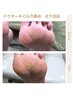 【足のプロにお任せ♪】たこ、うおのめケア＋かかとの角質ケア　（９０分）