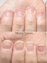 マリーロール 天王寺店(Marie Laure)/自爪育成/深爪矯正/ネイルケア