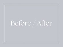 シェリーミル(Cherie Miru)/---症例写真---