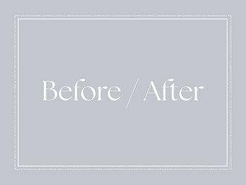 シェリーミル(Cherie Miru)/---症例写真---