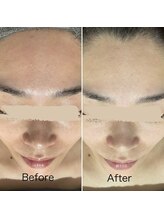 ≪毛穴洗浄肌質改善/小顔たるみケアSalon≫　泡のきもち【12/1 NEW OPEN（予定）】/美肌ケア◎うるおい生泡毛穴洗浄