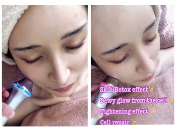 アルページュ(Arpege)の写真/ツルンと整い潤う滑らか艶肌♪最新の韓国の水玉フェイシャルLDM♪
毛穴開き/黒ずみ/角栓ゴワザラお悩み◎