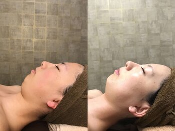 ジュメル 恵比寿店(Jumelles)/フェイシャル施術