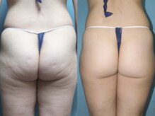 アルメリア(Armeria)/【結果写真】