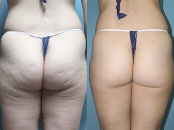 アルメリア(Armeria)/【結果写真】