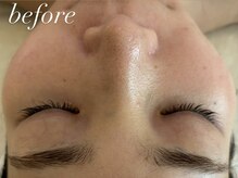 フォー(For...)/ララピール◇韓国肌管理