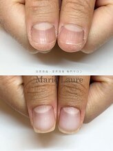 マリーロール 梅田店(Marie Laure)/自爪育成/深爪矯正/ネイルケア