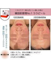 ミーカラー(mecalla.)/ララピールBA