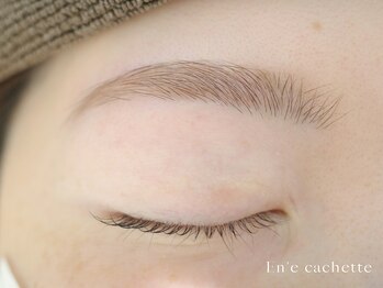 エンカシェット 代官山(En’e cachette)/【矯正美眉】美しいアーチに◎