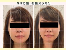 ルミナ(RUMINA)の雰囲気（NRフェイシャルロングコース一回での効果☆）
