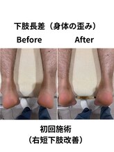 リターズ鍼灸治療所 天王寺院/Before/After