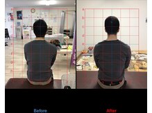 ストレチックス 近江八幡店/姿勢改善ビフォーアフター