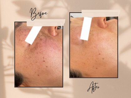 ロロメ(Rorome)の写真