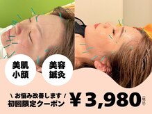 北てんま整骨鍼灸院の雰囲気（鍼が苦手な方でも大丈夫！極細の鍼で優しい刺激です。）