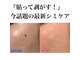 リリア(Lilia)の写真