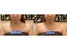 アジール 長岡リバーサイド千秋店(agir)/before/after画像