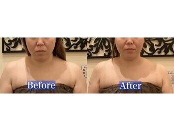 アジール 長岡リバーサイド千秋店(agir)/before/after画像