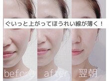 【肌育リフト】フェイスラインがキュッと！速攻小顔！肌育＆美白