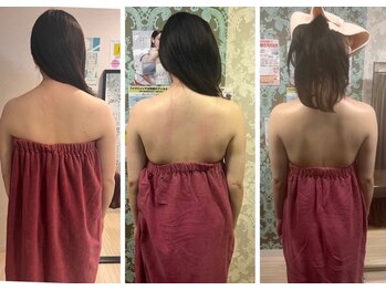 ロココ 豊田店(Rococo)/ビフォーアフター