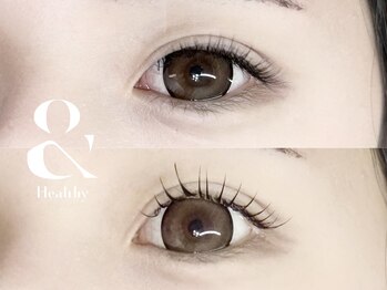 アイアンドネイル ブライト(bright)/アンドヘルシー